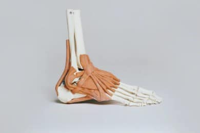 heel pain