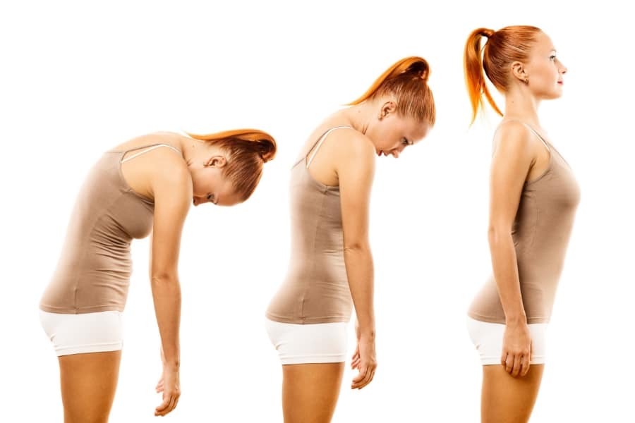 Three side-by-side views comparing a person's standing posture