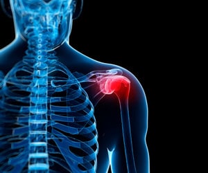 Anatomical illustration of the shoulder joint and bursa