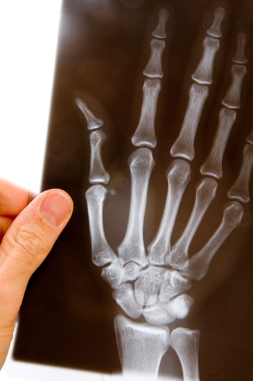 Doctor examining an X-ray of a hand